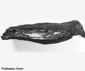 Radiographie de la momie SACHM 2545