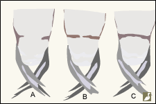 Types de barre ventrale sur des plongeons en plumages inter-nuptial et juvénile 